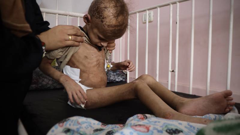 unrwa gazzede 3 yas alti her 3 cocuktan biri son 24 saati yiyeceksiz gecirdi eypBCAKm