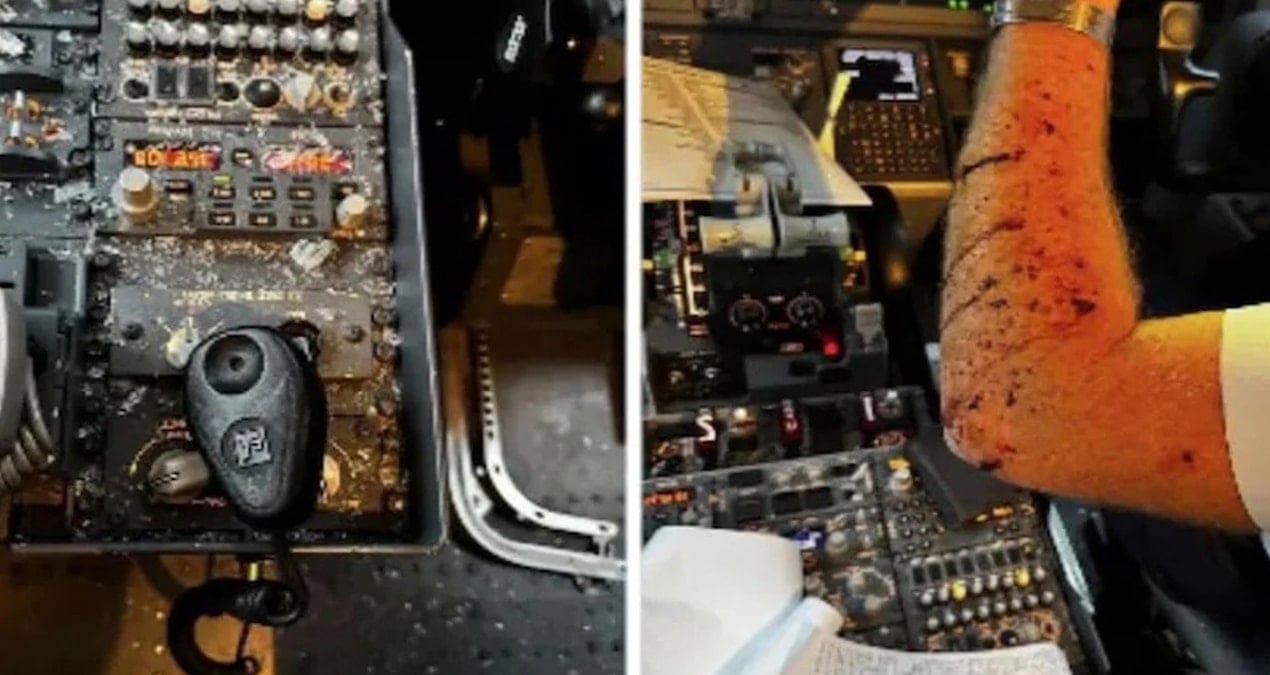 yolcu ucagina meteor carpti kokpit parcalandi pilot kanlar icinde kaldi 4qnvNI7k.jpg